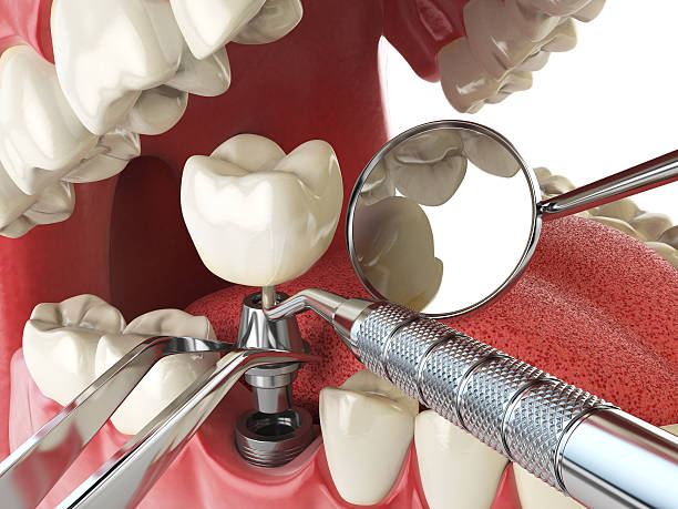 Best Dentist for Tooth Abscess  in Livingston, TN
